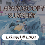 جراحی لاپاروسکوپی در شیراز