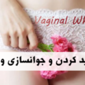 سفید کردن واژن در شیراز