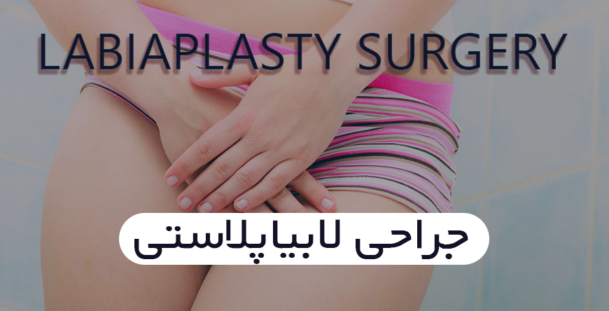 جراحی لابیاپلاستی در شیراز