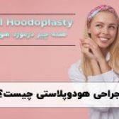 عمل جراحی هودوپلاستی در شیراز