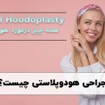 عمل جراحی هودوپلاستی در شیراز