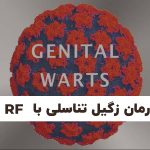 درمان زگیل تناسلی با RF در شیراز