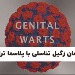 درمان زگیل تناسلی با پلاسماتراپی در شیراز