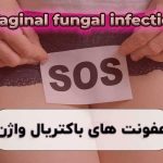درمان عفونت های باکتریال واژینال در شیراز