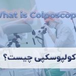 کولپوسکوپی چیست ؟