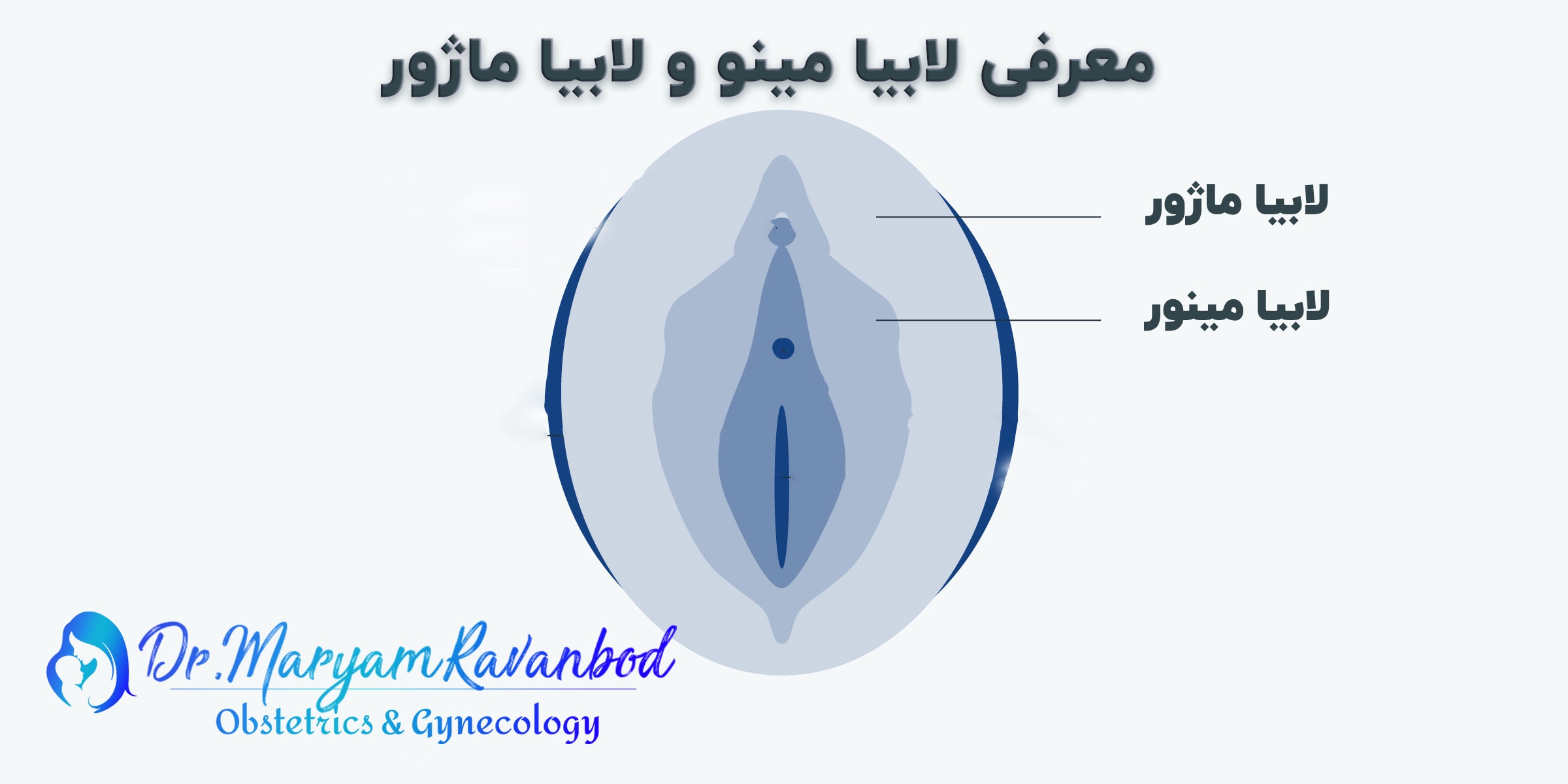 لابیاپلاستی در شیراز