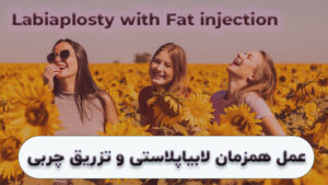 لابیاپلاستی و تزریق چربی در شیراز