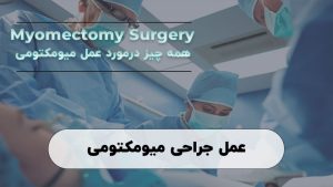 جراحی میومکتومی