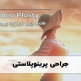 پرینوپلاستی در شیراز