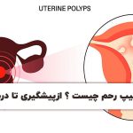 پولیپ رحم چیست؟ تشخیص، درمان و پیشگیری